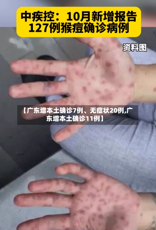 【广东增本土确诊7例	、无症状20例,广东增本土确诊11例】-第3张图片